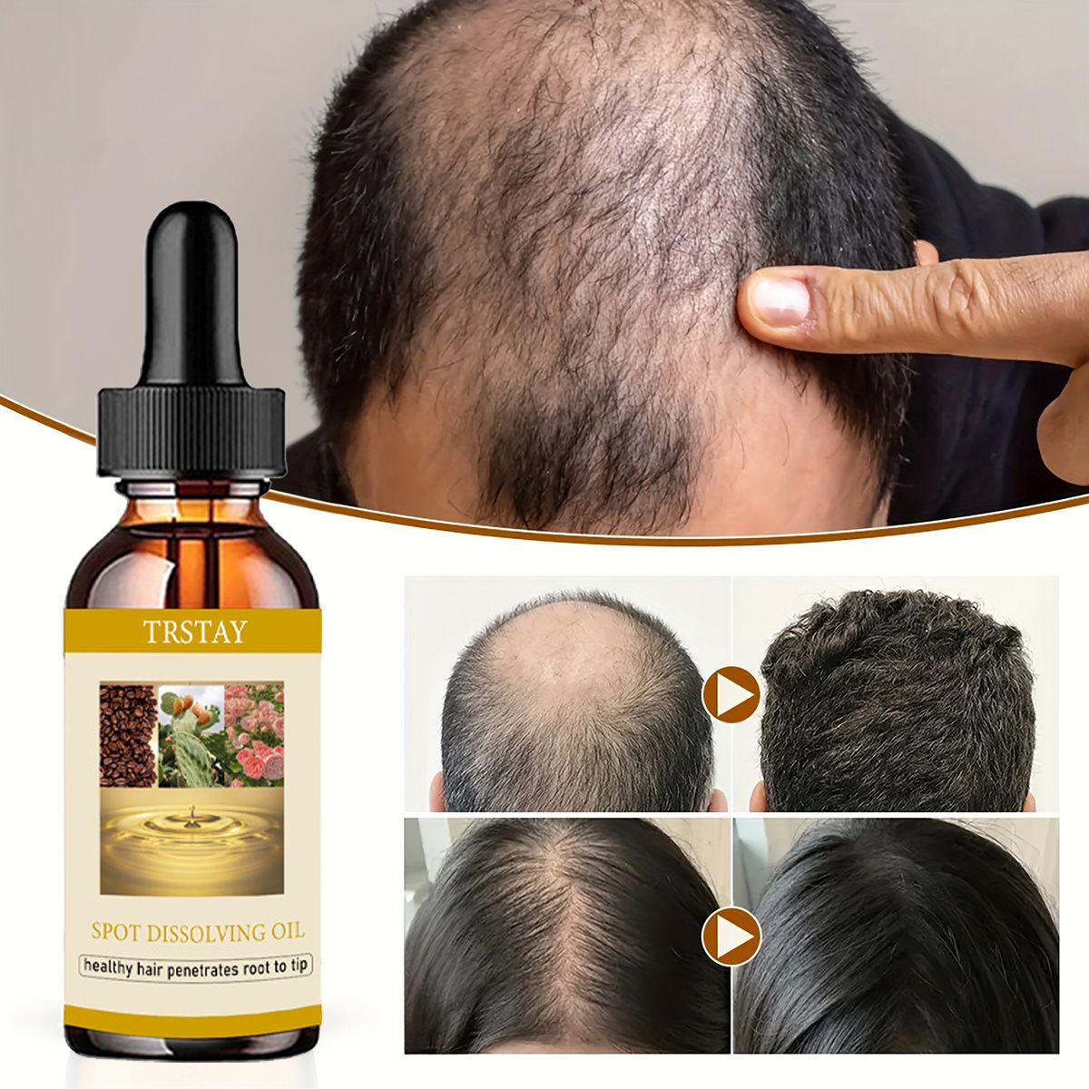 50ML Mọc Râu Tinh Dầu Chống Rụ - đánh giá và giá Beard Oil