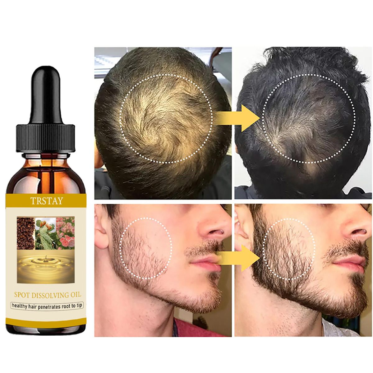 50ML Mọc Râu Tinh Dầu Chống Rụ - đánh giá và giá Beard Oil