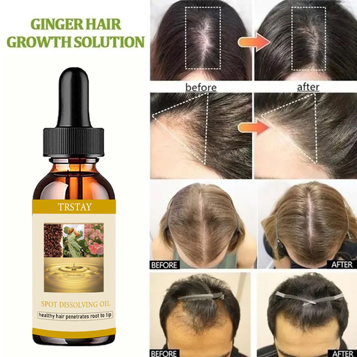 50ML Mọc Râu Tinh Dầu Chống Rụ - đánh giá và giá Beard Oil